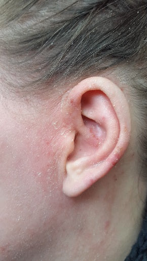 Q for Skin