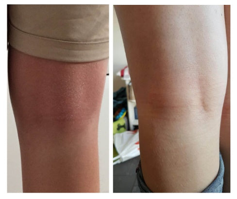 Q for Skin