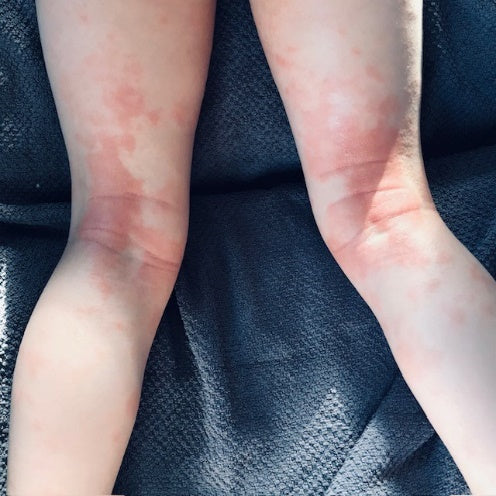 Q for Skin